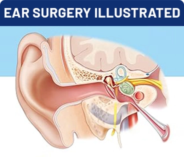 Ear Surgery Illustrated Ear Surgery Illustrated